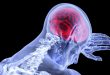 Ученые из Оксфордского университета назвали факторы риска ускоренного старения мозга.